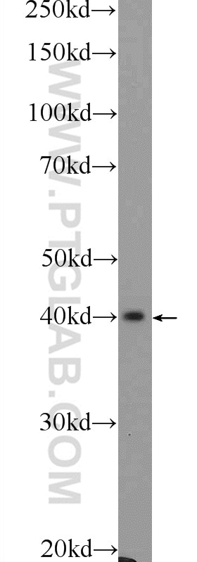 Western Blot (WB) analysis of mouse pancreas tissue using FIBP Polyclonal antibody (15968-1-AP)