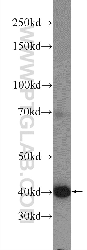 Western Blot (WB) analysis of BxPC-3 cells using FIBP Polyclonal antibody (15968-1-AP)