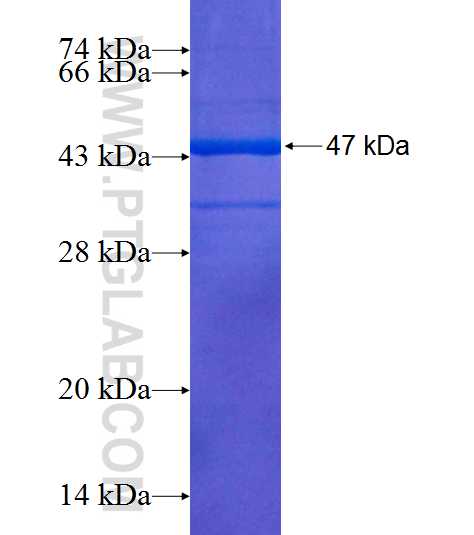 FIBP fusion protein Ag9097 SDS-PAGE