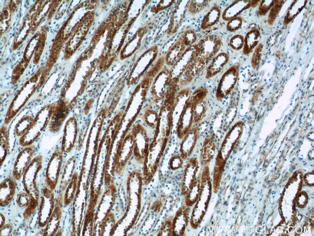 Immunohistochemistry (IHC) staining of human kidney tissue using FICD Polyclonal antibody (11974-1-AP)