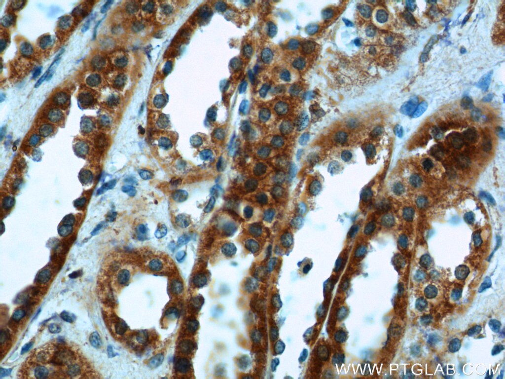 Immunohistochemistry (IHC) staining of human kidney tissue using FICD Polyclonal antibody (11974-1-AP)