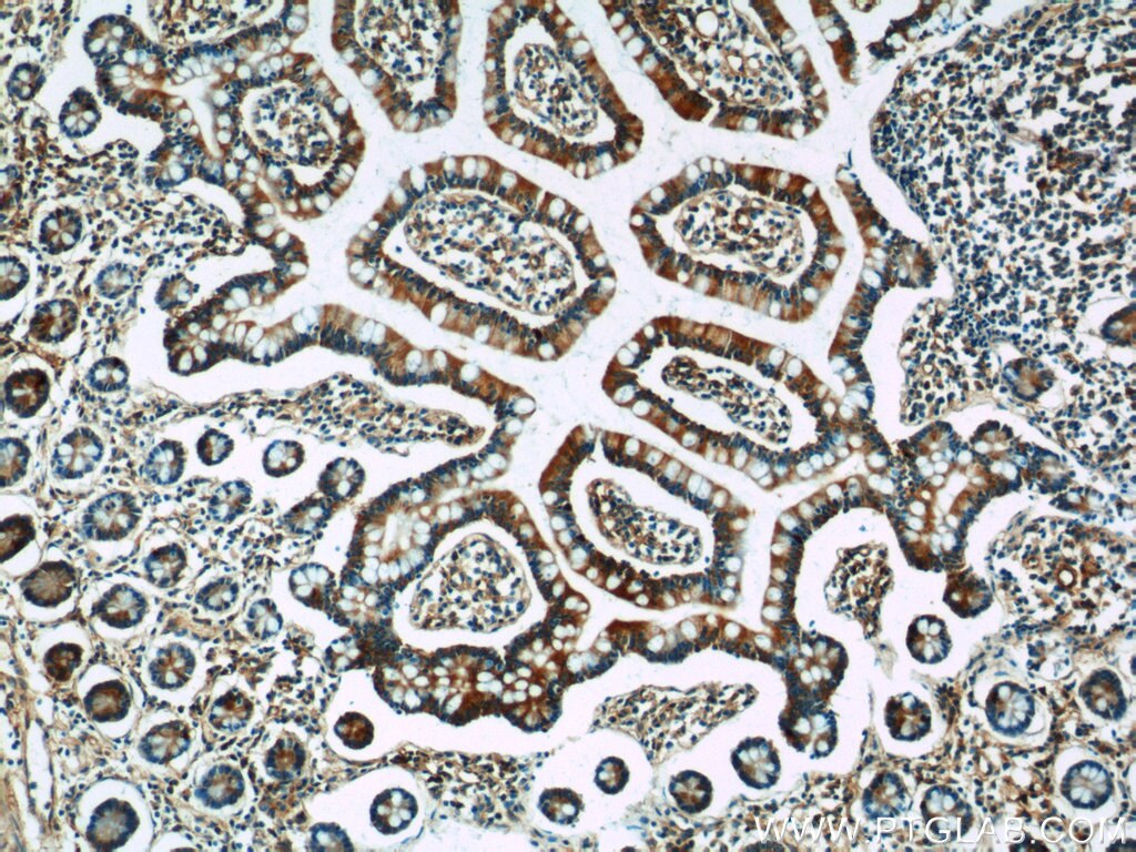 Immunohistochemistry (IHC) staining of human small intestine tissue using FICD Polyclonal antibody (11974-1-AP)