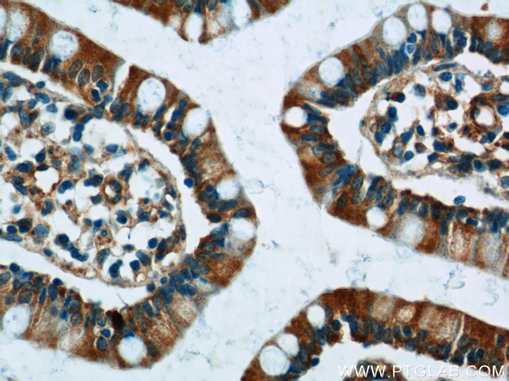 Immunohistochemistry (IHC) staining of human small intestine tissue using FICD Polyclonal antibody (11974-1-AP)