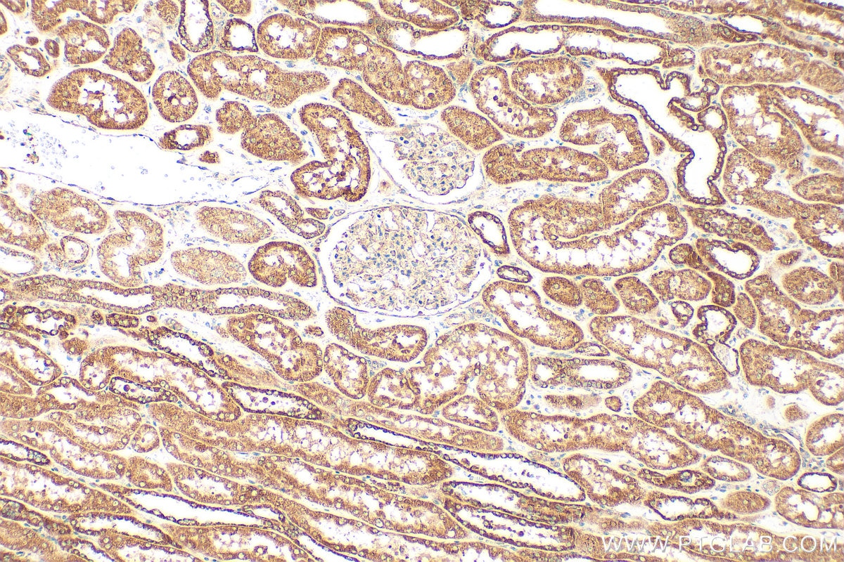 Immunohistochemistry (IHC) staining of human kidney tissue using FICD Polyclonal antibody (11974-1-AP)