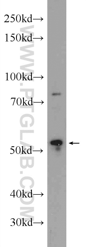Western Blot (WB) analysis of Jurkat cells using FICD Polyclonal antibody (11974-1-AP)