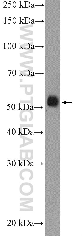 Western Blot (WB) analysis of A549 cells using FICD Polyclonal antibody (11974-1-AP)