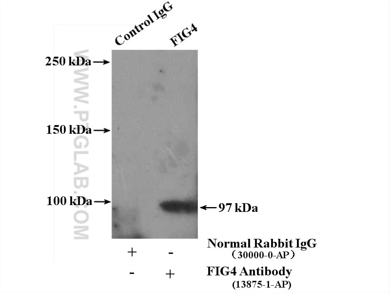 Immunoprecipitation (IP) experiment of COS-7 cells using FIG4 Polyclonal antibody (13875-1-AP)