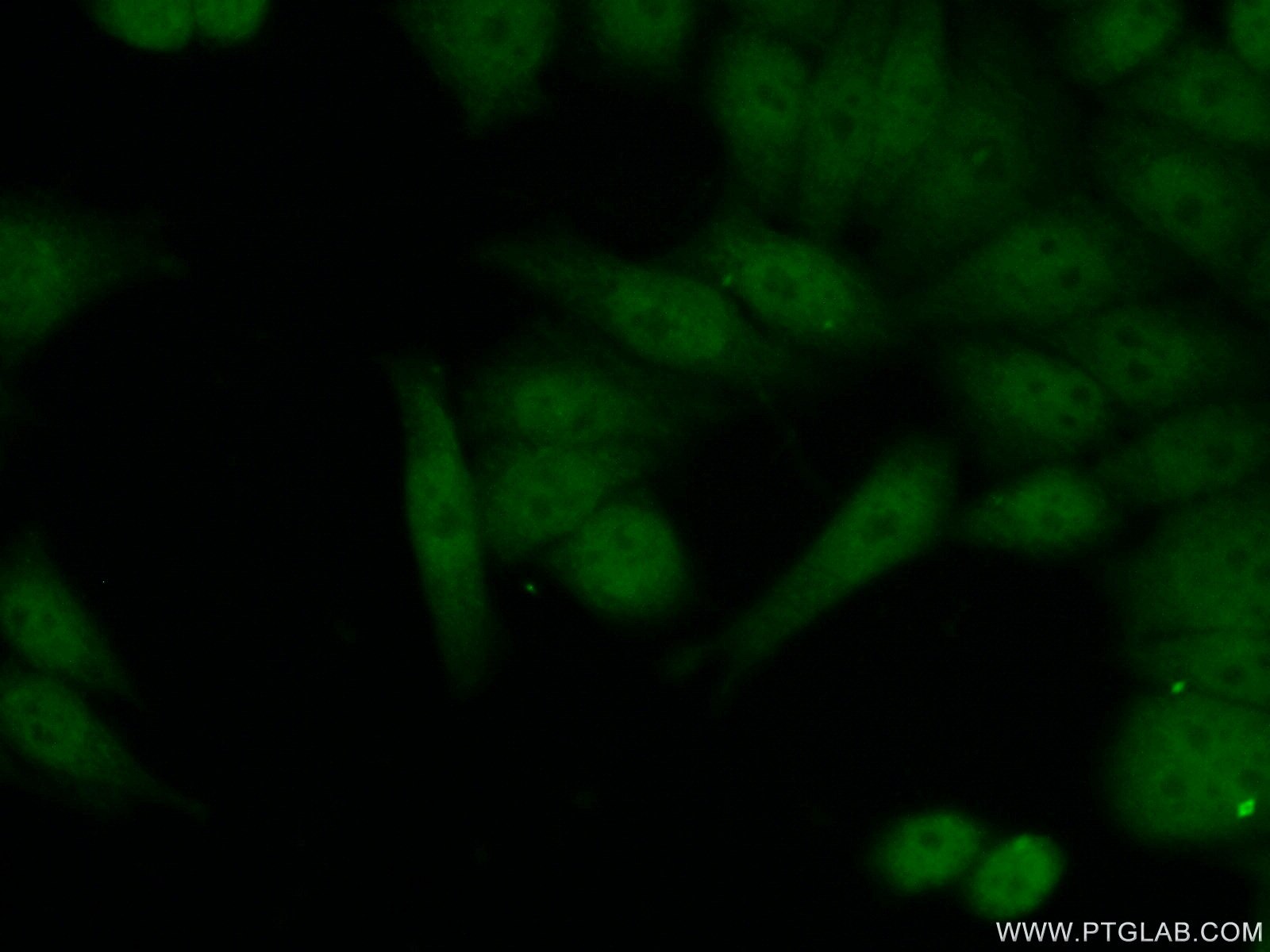 Immunofluorescence (IF) / fluorescent staining of HeLa cells using FIGNL1 Polyclonal antibody (17604-1-AP)