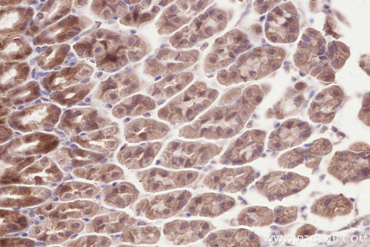 IHC staining of mouse stomach using 17604-1-AP Immunohistochemistry (IHC) staining of mouse stomach tissue using FIGNL1 Polyclonal antibody (17604-1-AP)