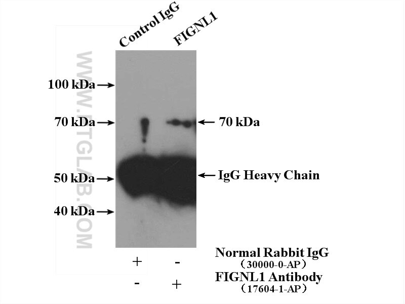 Immunoprecipitation (IP) experiment of HeLa cells using FIGNL1 Polyclonal antibody (17604-1-AP)