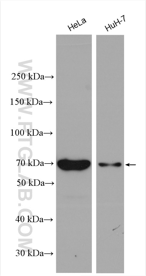 Western Blot (WB) analysis of various lysates using FIGNL1 Polyclonal antibody (17604-1-AP)