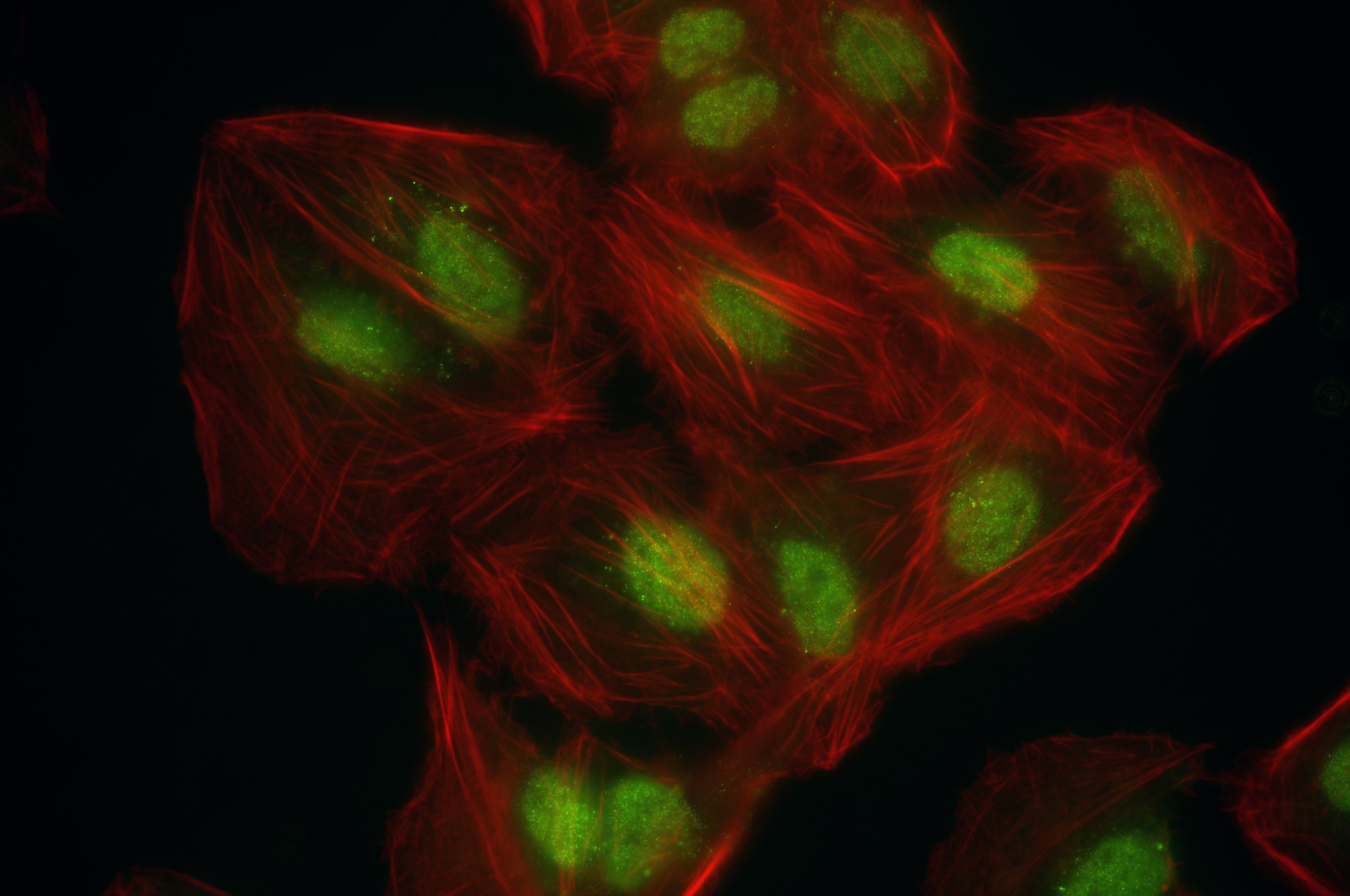 IF Staining of U2OS using 86971-2-RR Immunofluorescence (IF) / fluorescent staining of U2OS cells using FIGNL1 Recombinant monoclonal antibody (86971-2-RR)