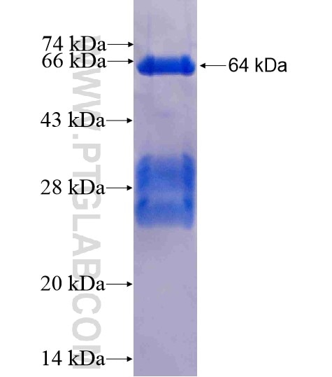 FIGNL1 fusion protein Ag11709 SDS-PAGE