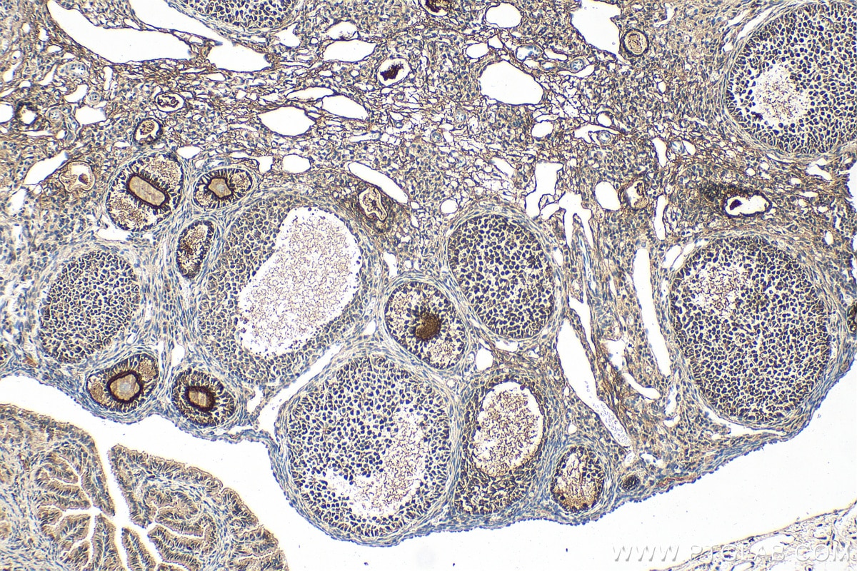 Immunohistochemistry (IHC) staining of mouse ovary tissue using FILIP1L Polyclonal antibody (30134-1-AP)