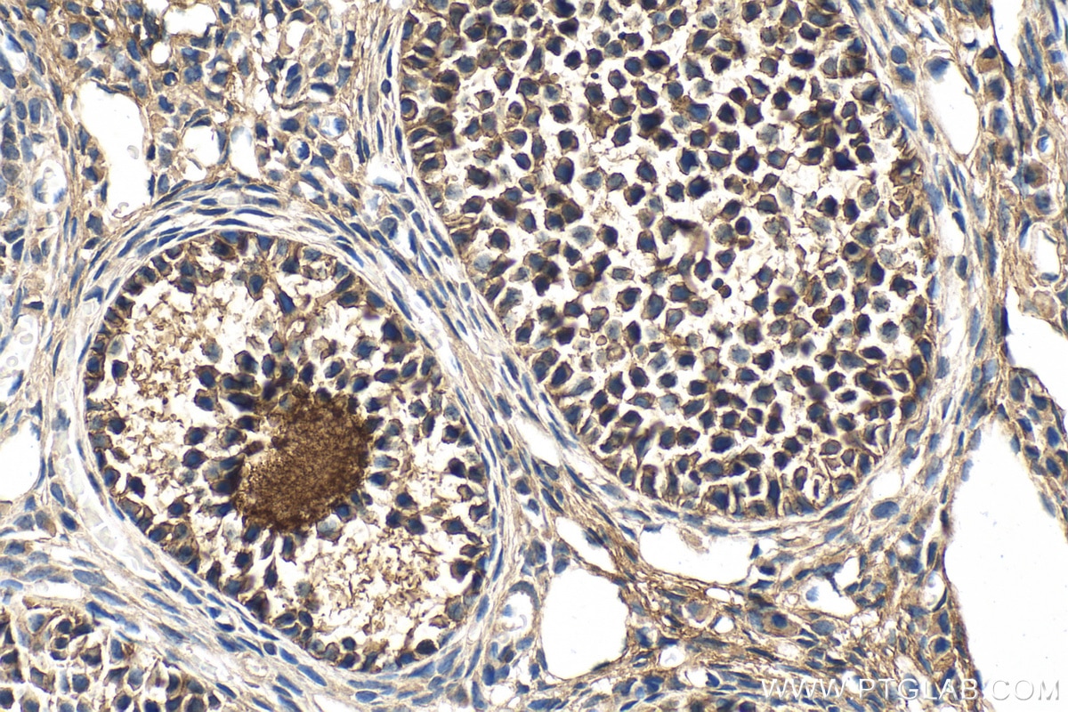 Immunohistochemistry (IHC) staining of mouse ovary tissue using FILIP1L Polyclonal antibody (30134-1-AP)
