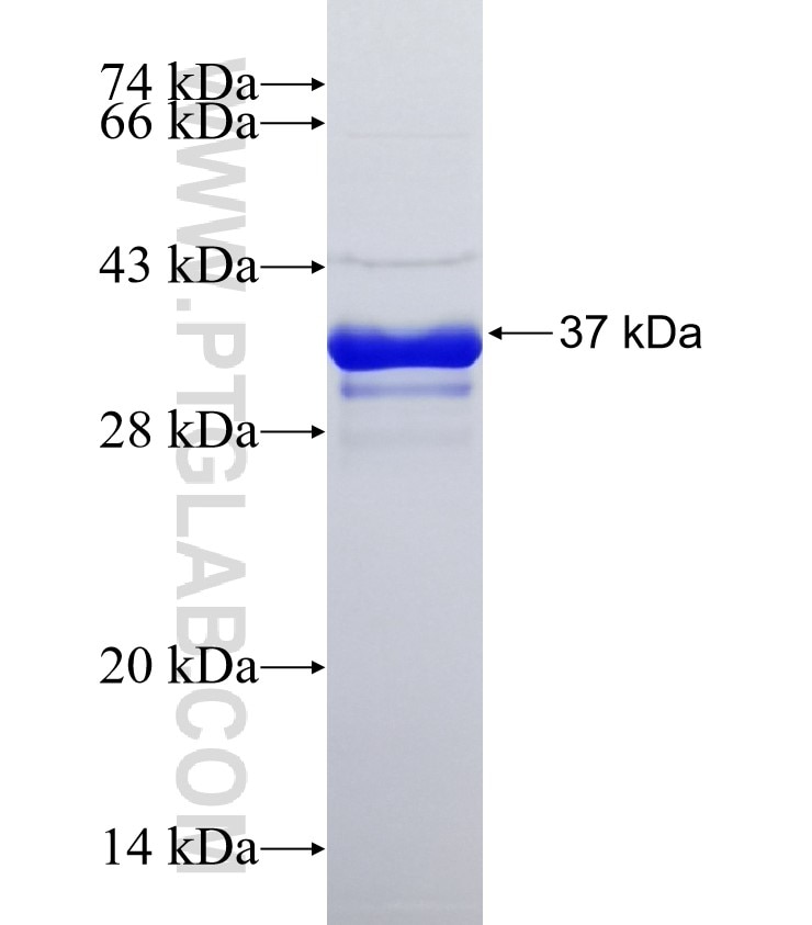 FILIP1L fusion protein Ag32655 SDS-PAGE
