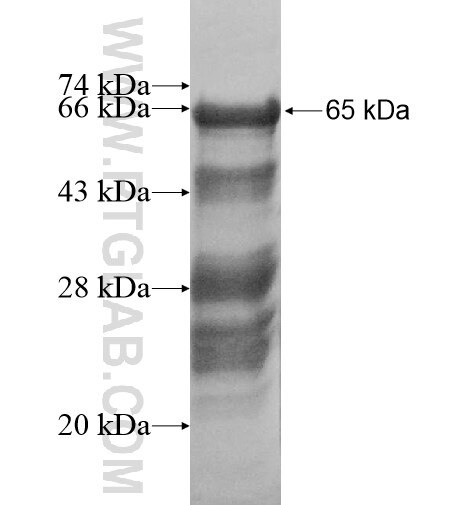 FILIP1L fusion protein Ag11248 SDS-PAGE