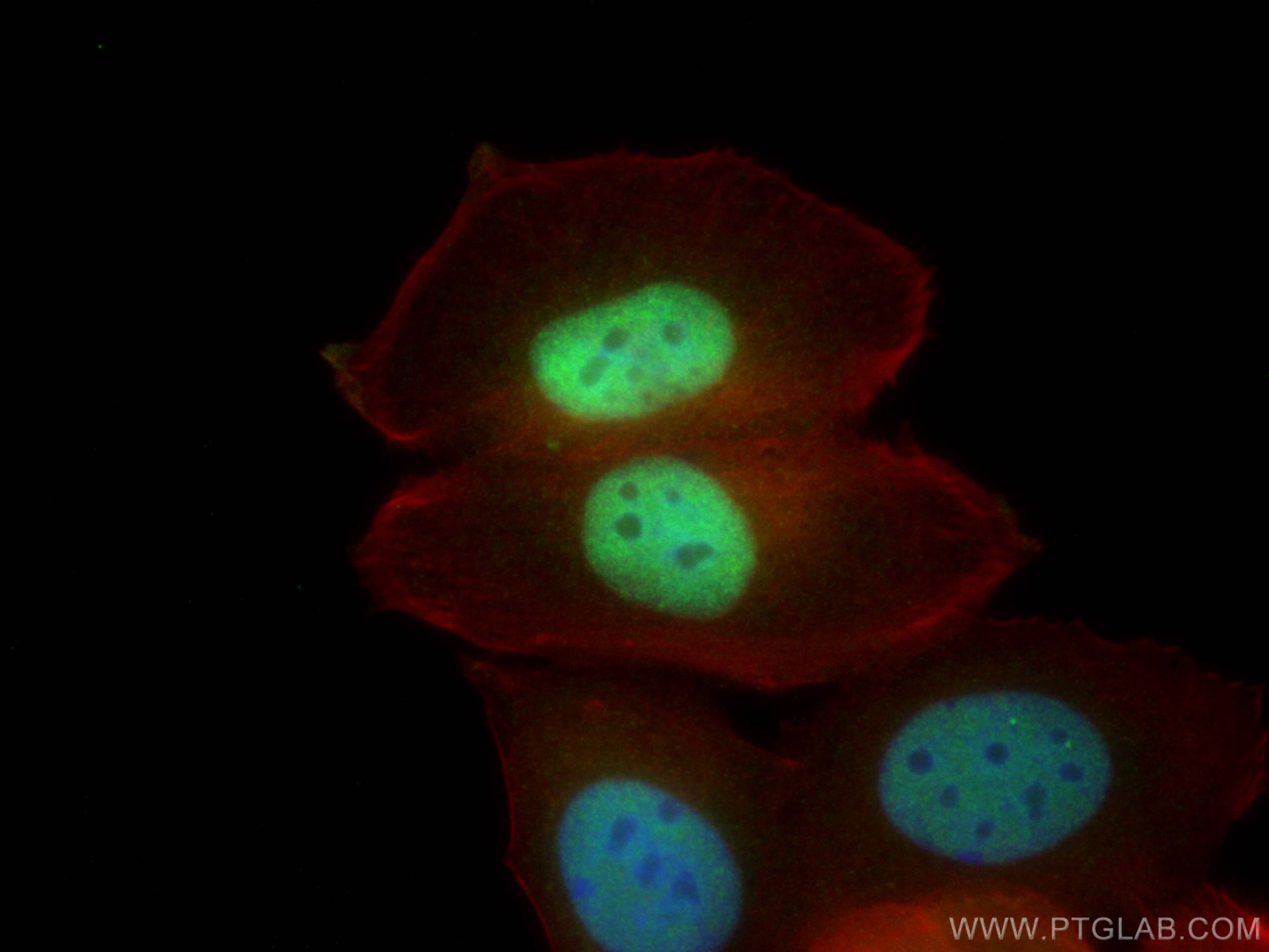 Immunofluorescence (IF) / fluorescent staining of MCF-7 cells using FIP1L1 Polyclonal antibody (12276-1-AP)