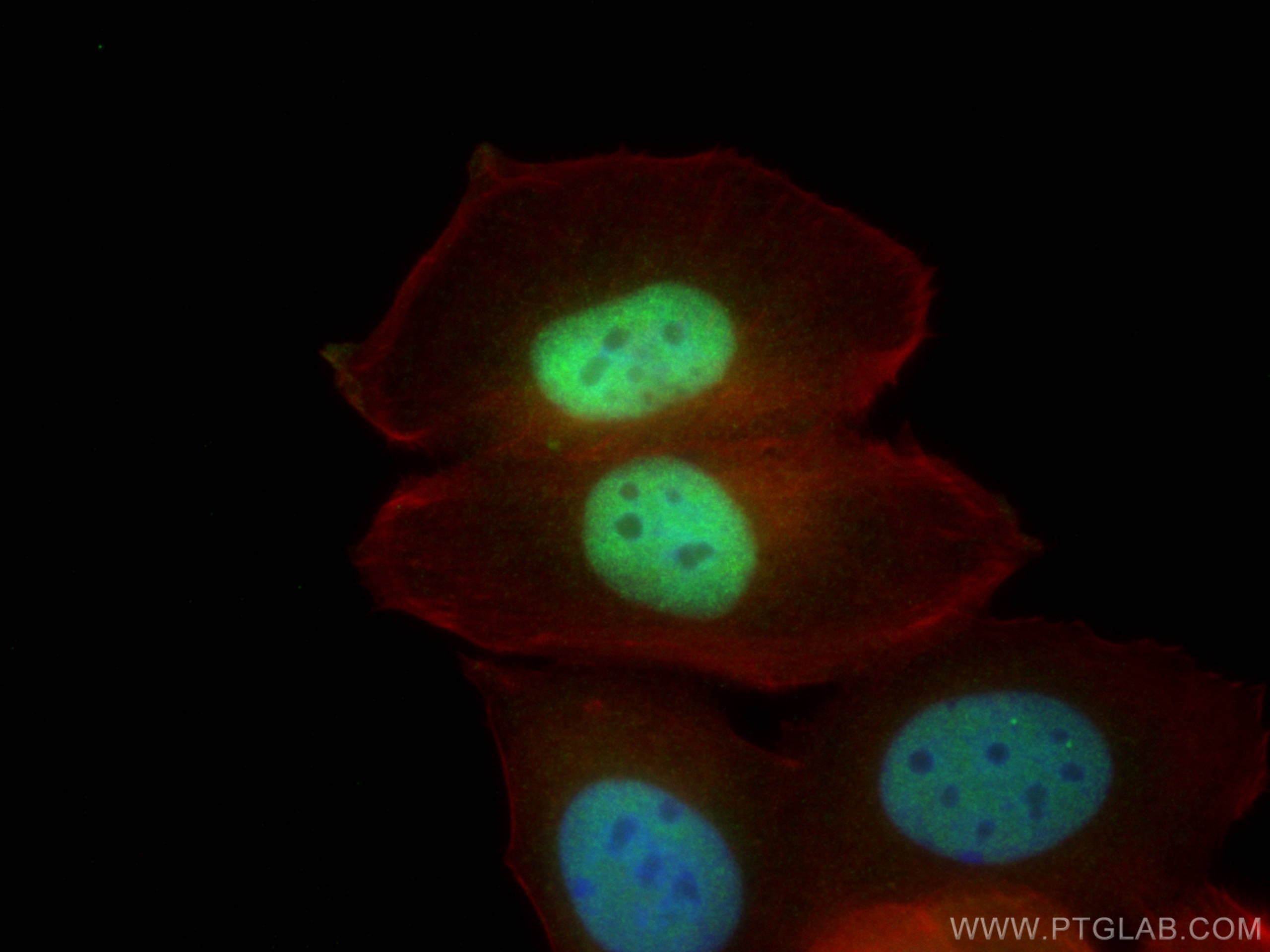 IF Staining of MCF-7 using 12276-1-AP