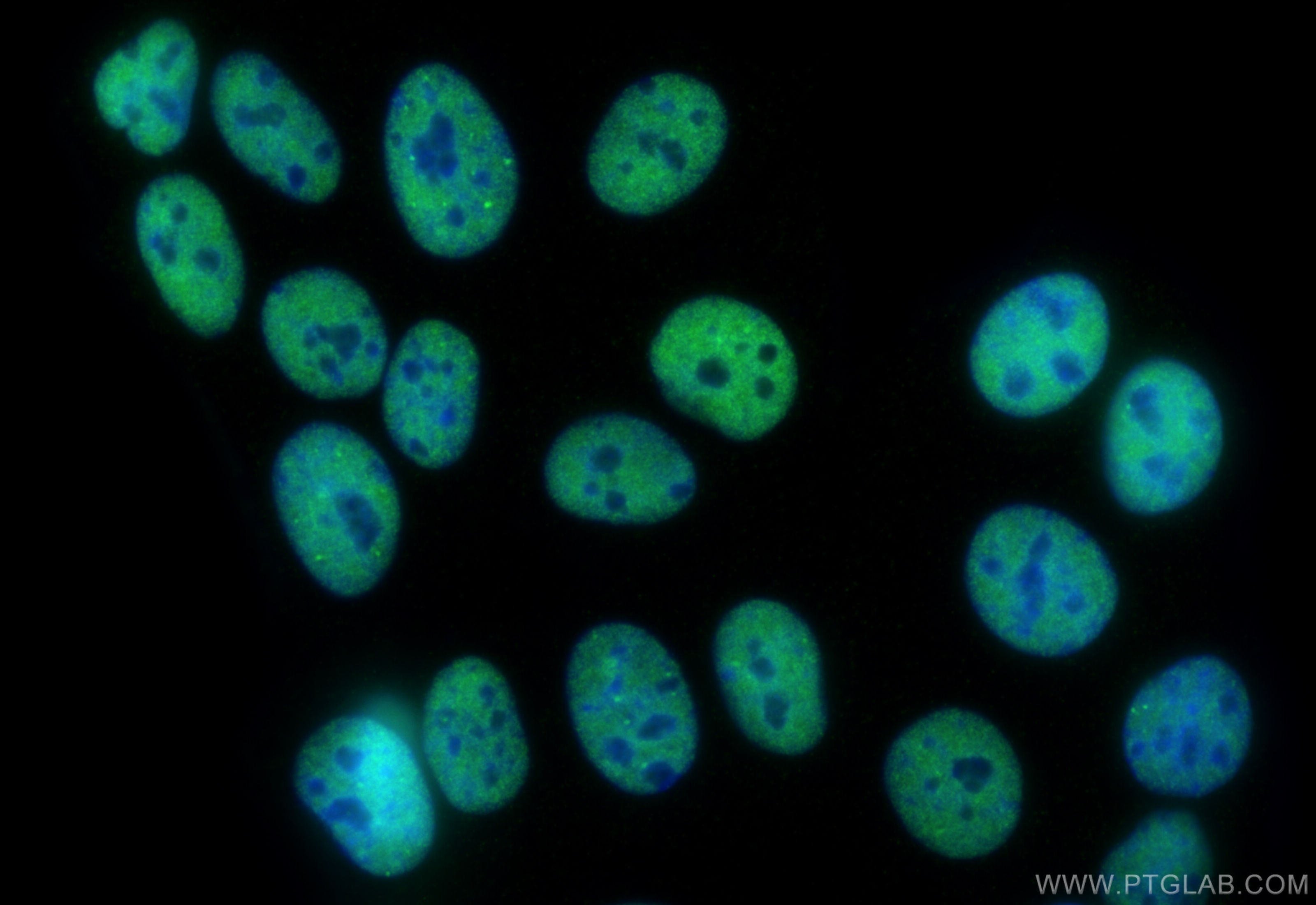 Immunofluorescence (IF) / fluorescent staining of MCF-7 cells using FIP1L1 Polyclonal antibody (12276-1-AP)