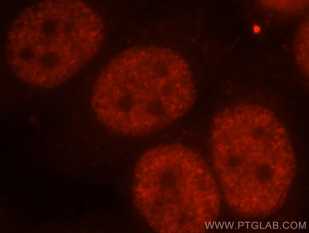 Immunofluorescence (IF) / fluorescent staining of MCF-7 cells using FIP1L1 Polyclonal antibody (12276-1-AP)