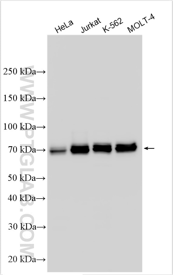 Western Blot (WB) analysis of various lysates using FIP1L1 Polyclonal antibody (12276-1-AP)