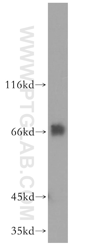Western Blot (WB) analysis of K-562 cells using FIP1L1 Polyclonal antibody (12276-1-AP)