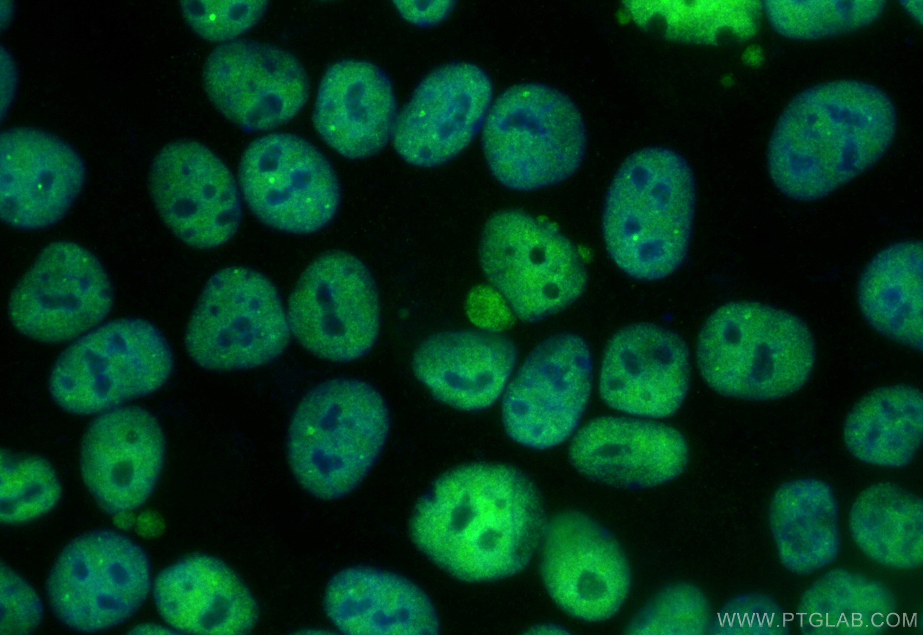Immunofluorescence (IF) / fluorescent staining of MCF-7 cells using CoraLite® Plus 488-conjugated FIP1L1 Recombinant a (CL488-83863-3)