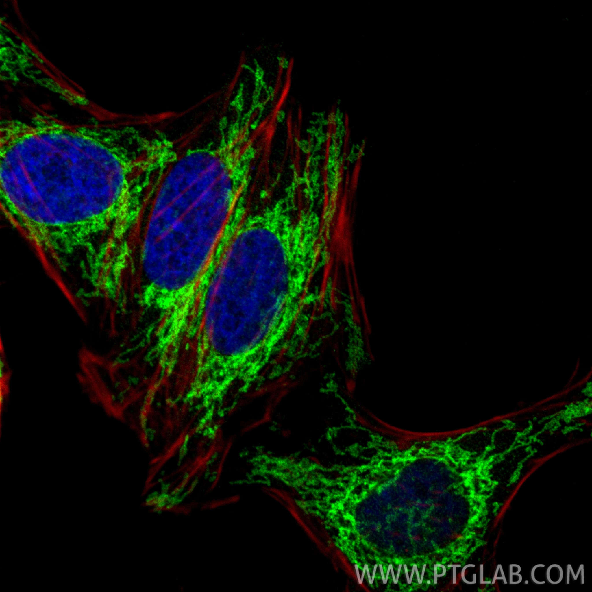 Immunofluorescence (IF) / fluorescent staining of HepG2 cells using FIS1 Polyclonal antibody (10956-1-AP)
