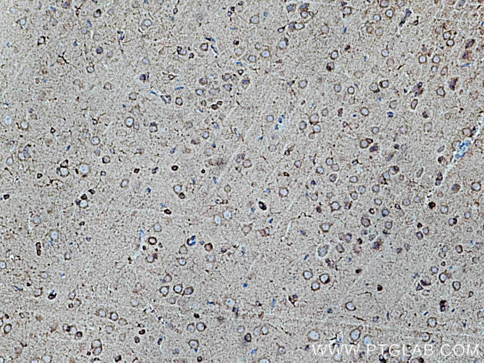 Immunohistochemistry (IHC) staining of rat brain tissue using FIS1 Polyclonal antibody (10956-1-AP)