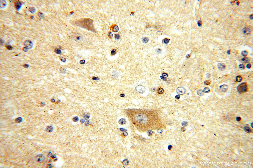 Immunohistochemistry (IHC) staining of human brain tissue using FIS1 Polyclonal antibody (10956-1-AP)