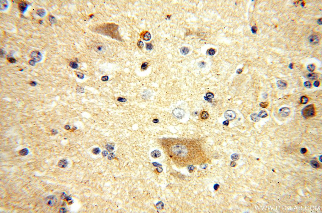 IHC staining of human brain using 10956-1-AP