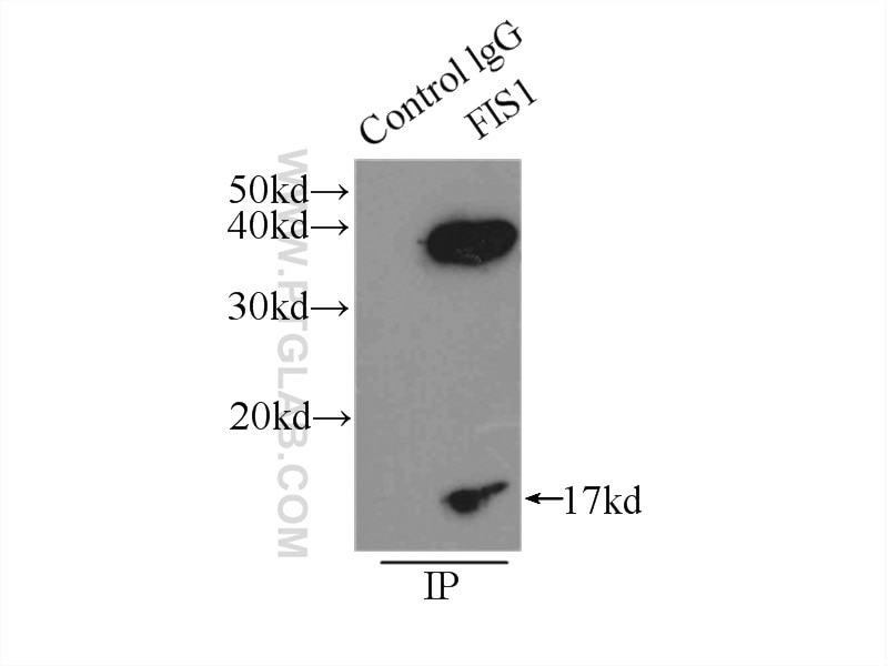 Immunoprecipitation (IP) experiment of HeLa cells using FIS1 Polyclonal antibody (10956-1-AP)