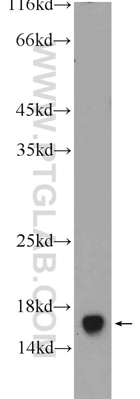 Western Blot (WB) analysis of rat brain tissue using FIS1 Polyclonal antibody (10956-1-AP)