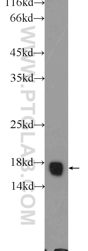 Western Blot (WB) analysis of rat heart tissue using FIS1 Polyclonal antibody (10956-1-AP)