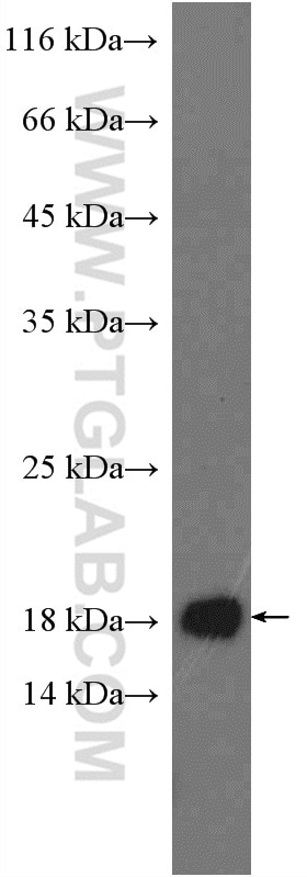 Western Blot (WB) analysis of SH-SY5Y cells using FIS1 Polyclonal antibody (10956-1-AP)