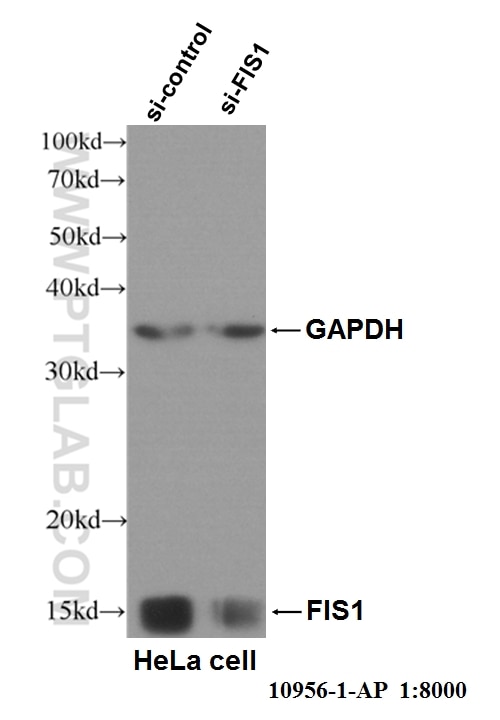 Western Blot (WB) analysis of HeLa cells using FIS1 Polyclonal antibody (10956-1-AP)
