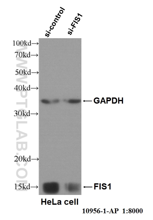 WB analysis of HeLa cells using 10956-1-AP