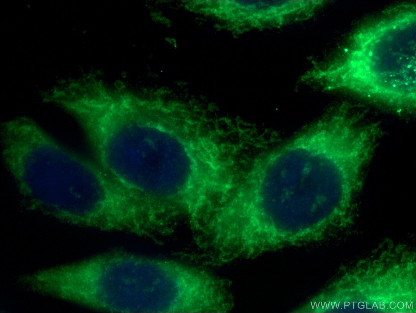 Immunofluorescence (IF) / fluorescent staining of HepG2 cells using FIS1 Monoclonal antibody (66635-1-Ig)