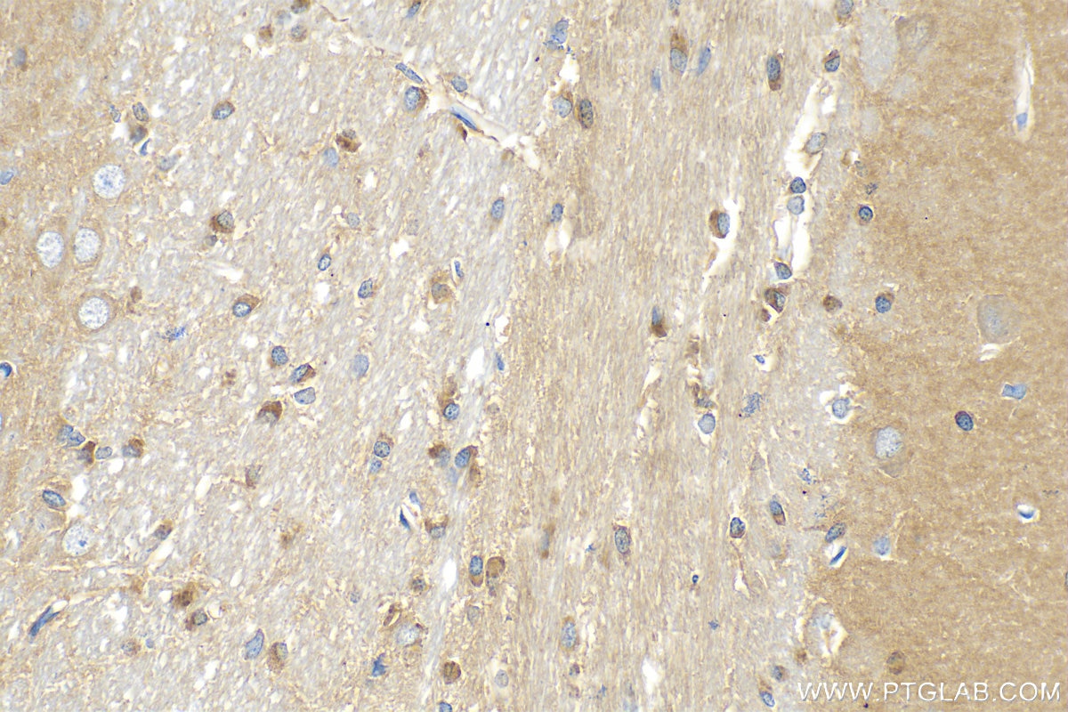 Immunohistochemistry (IHC) staining of rat brain tissue using FIS1 Recombinant antibody (82248-1-RR)