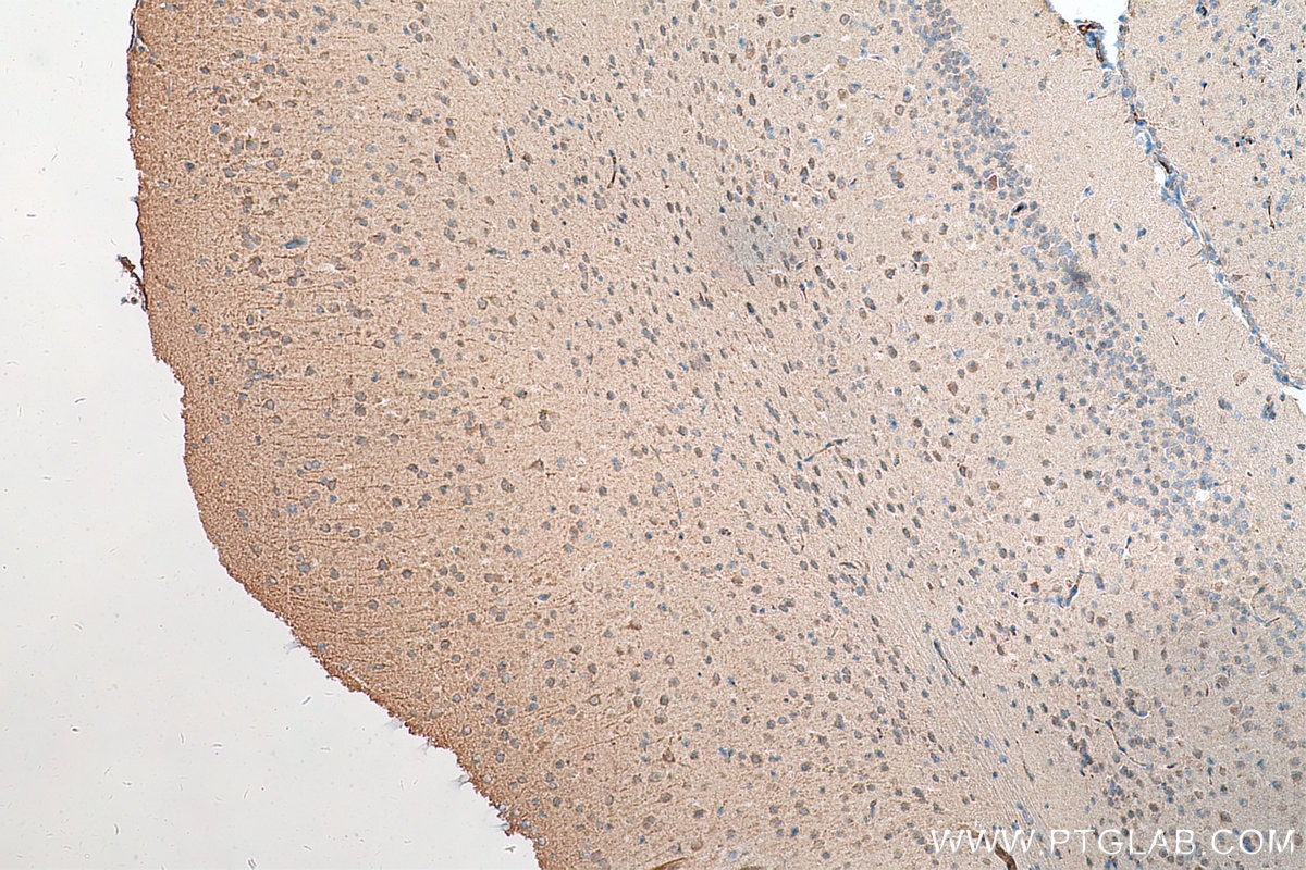 Immunohistochemistry (IHC) staining of mouse brain tissue using FJX1 Polyclonal antibody (17417-1-AP)