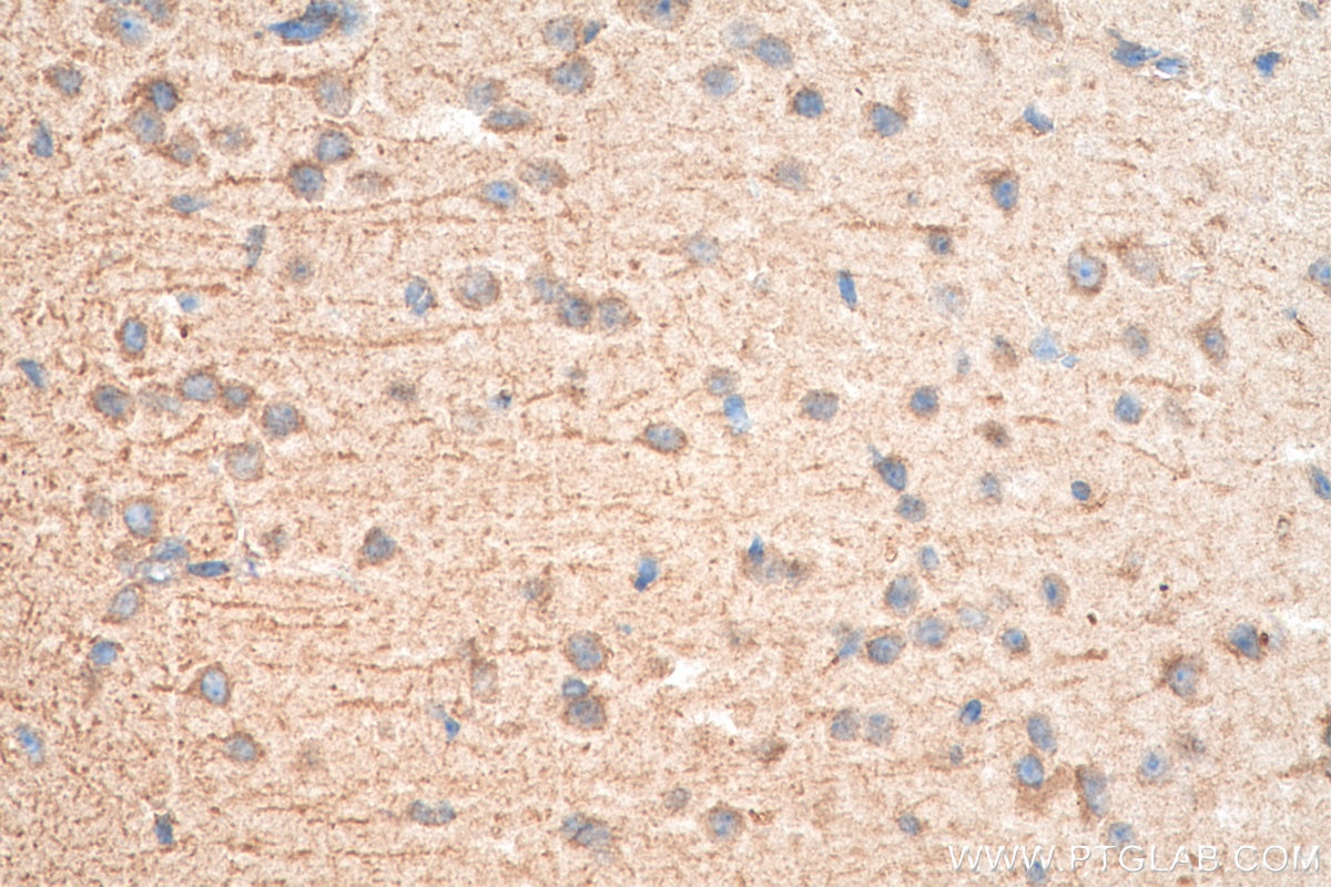 Immunohistochemistry (IHC) staining of mouse brain tissue using FJX1 Polyclonal antibody (17417-1-AP)