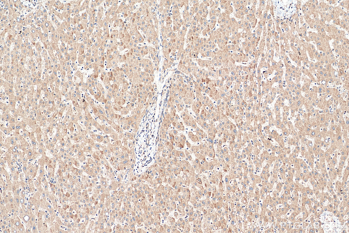 Immunohistochemistry (IHC) staining of human liver tissue using FJX1 Polyclonal antibody (17417-1-AP)