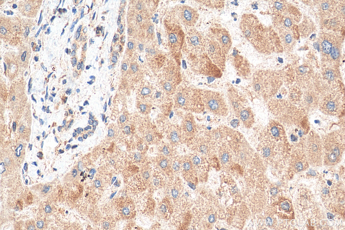 Immunohistochemistry (IHC) staining of human liver tissue using FJX1 Polyclonal antibody (17417-1-AP)