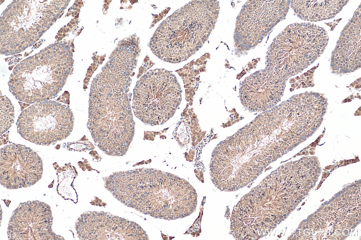 Immunohistochemistry (IHC) staining of mouse testis tissue using FJX1 Polyclonal antibody (17417-1-AP)