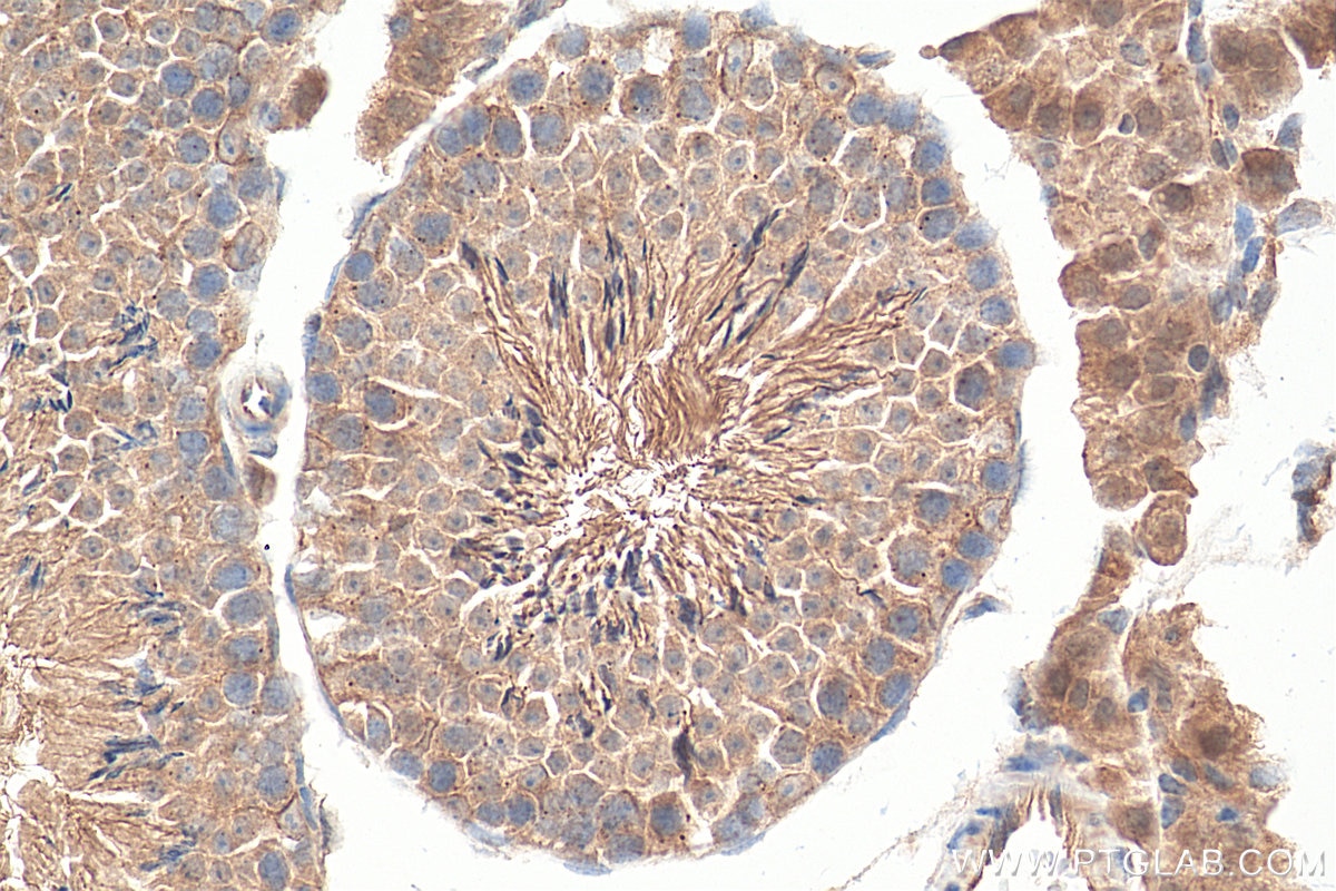 Immunohistochemistry (IHC) staining of mouse testis tissue using FJX1 Polyclonal antibody (17417-1-AP)