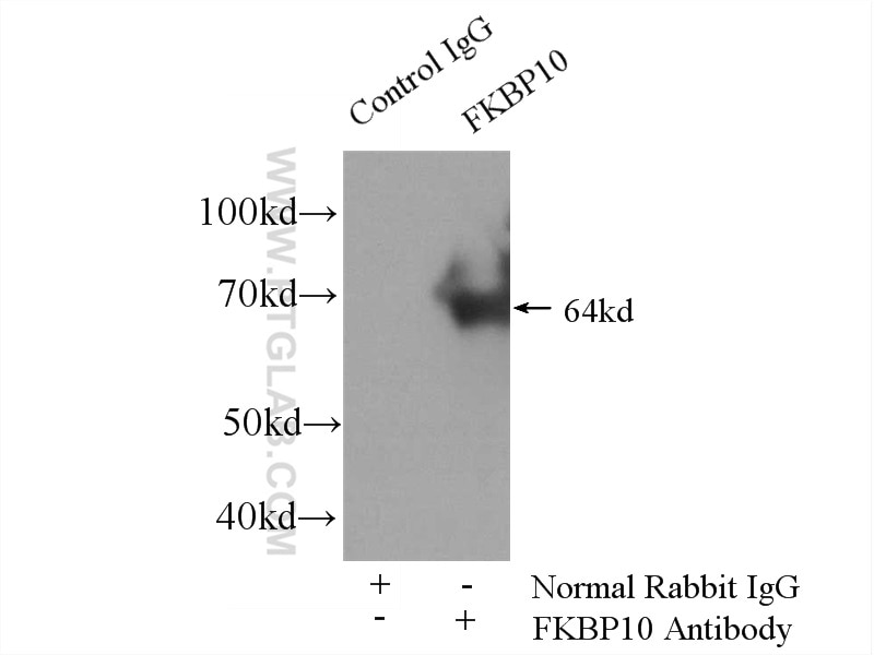 Immunoprecipitation (IP) experiment of HEK-293 cells using FKBP10/FKBP65 Polyclonal antibody (12172-1-AP)
