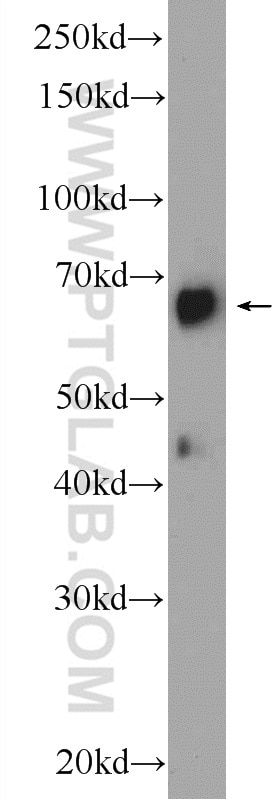 Western Blot (WB) analysis of fetal human brain tissue using FKBP10/FKBP65 Polyclonal antibody (12172-1-AP)