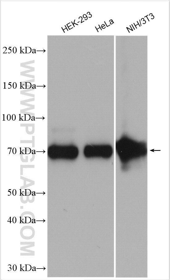 Western Blot (WB) analysis of various lysates using FKBP10/FKBP65 Polyclonal antibody (12172-1-AP)