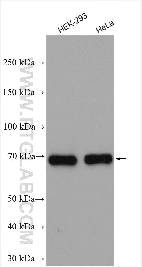 Western Blot (WB) analysis of various lysates using FKBP10/FKBP65 Polyclonal antibody (12172-1-AP)